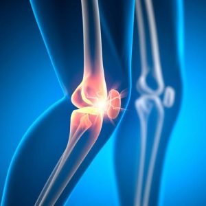 Knee Pain and Arthritis Physiotherapy in Varanasi